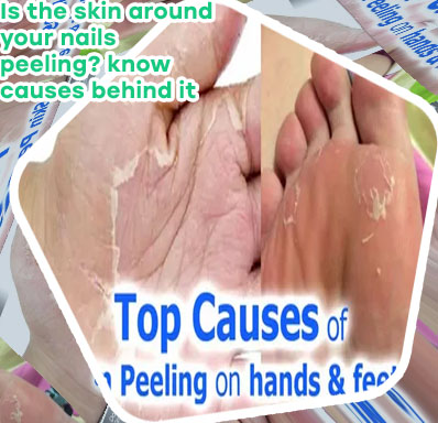 Hand skin peeling treatment