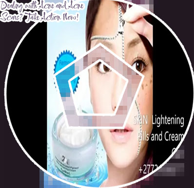 Natural acne scar lightener