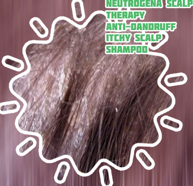 Really dry and flaky scalp