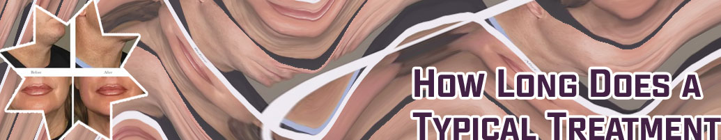Ultherapy neck near me